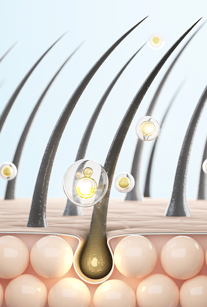 Comprehensive Hair Loss Solution