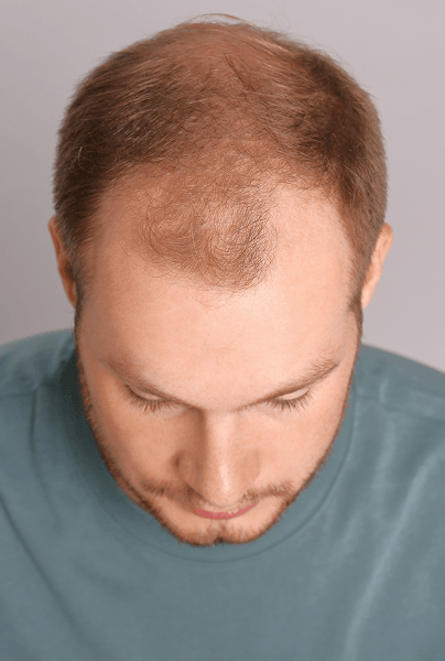 Stronger Results for Advanced Cases